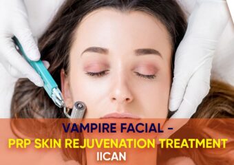 Vampire Facial – PRP Skin Rejuvenation Treatment – IICAN