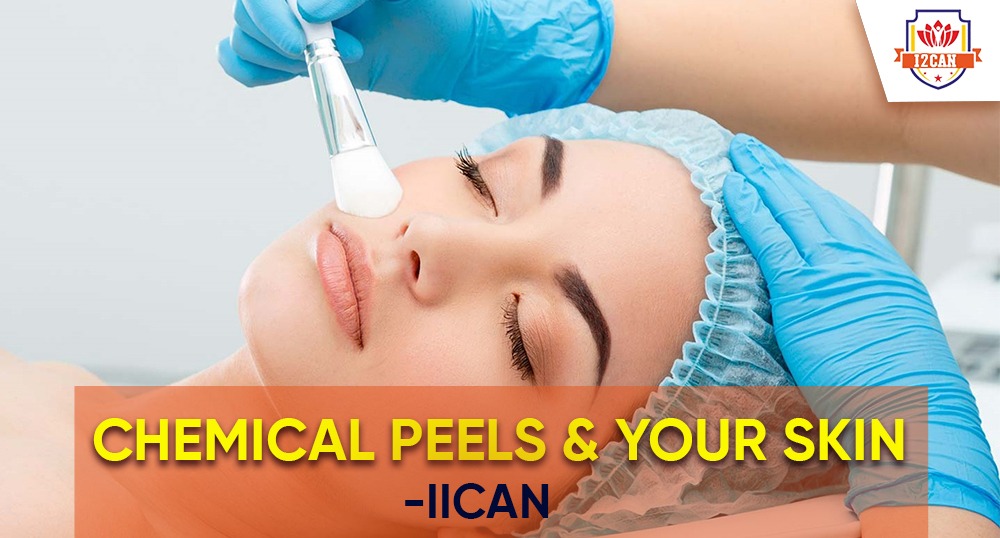 Chemical Peels and Your Skin - IICAN
