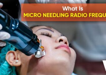 What is Micro Needling Radio Frequency 