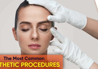 The Most common aesthetic procedures