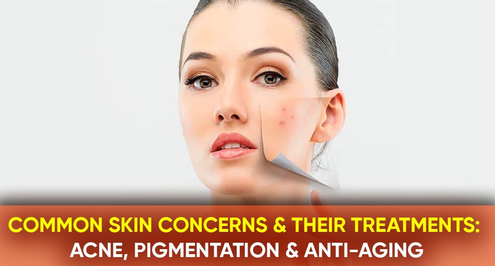 Common Skin Concerns and Their Treatments Acne, Pigmentation, and Anti