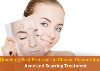 Unveiling Best Practices in Clinical Cosmetology for Acne and Scarring Treatment