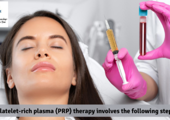 Platelet-rich plasma (PRP) therapy involves the following steps: