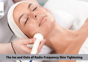 The Ins and Outs of Radio Frequency Skin Tightening