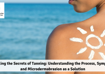 ￼Unveiling the Secrets of Tanning: Understanding the Process, Symptoms, and Microdermabrasion as a Solution