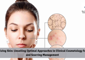 Revitalizing Skin: Unveiling Optimal Approaches in Clinical Cosmetology for Acne and Scarring Management