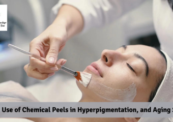 The Use of Chemical Peels in Hyperpigmentation, and Aging Skin