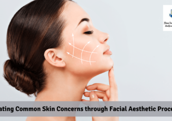 Navigating Common Skin Concerns through Facial Aesthetic Procedures