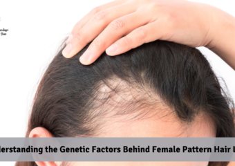Understanding the Genetic Factors Behind Female Pattern Hair Loss