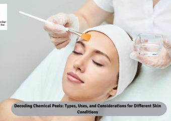 Decoding Chemical Peels: Types, Uses, and Considerations for Different Skin Conditions