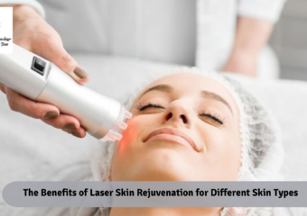 The Benefits of Laser Skin Rejuvenation for Different Skin Types
