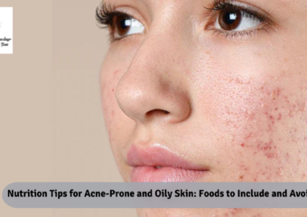 Nutrition Tips for Acne-Prone and Oily Skin: Foods to Include and Avoid