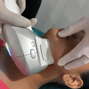 Hands-on demonstration of handheld laser device for skin treatment during PGDCC practical training at I2CAN Vadodara