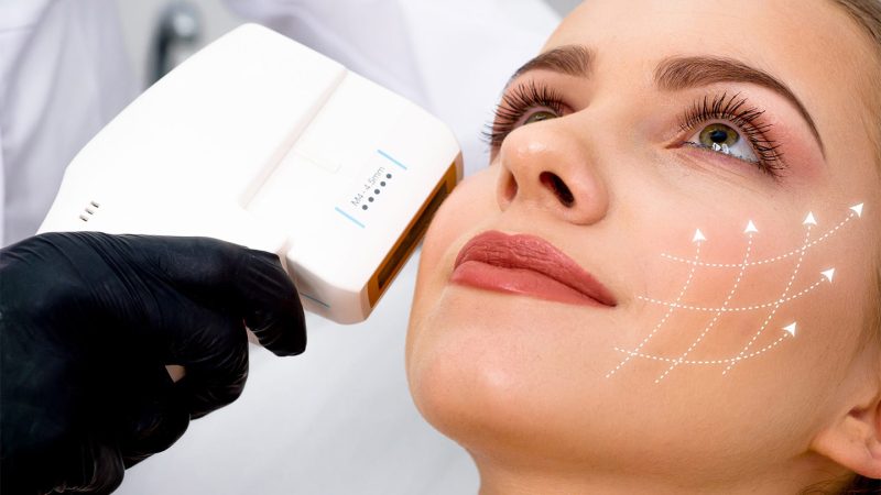 1594127419_hifu_exclusivebeauty