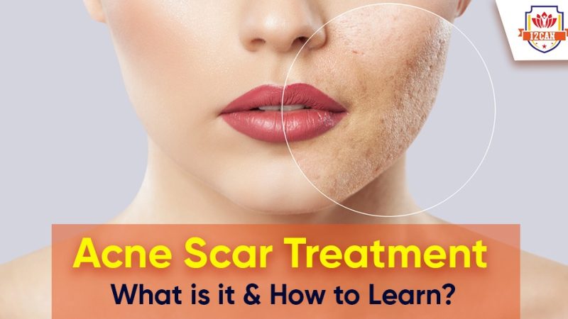 What is Botox Treatment? Learn With IICAN.