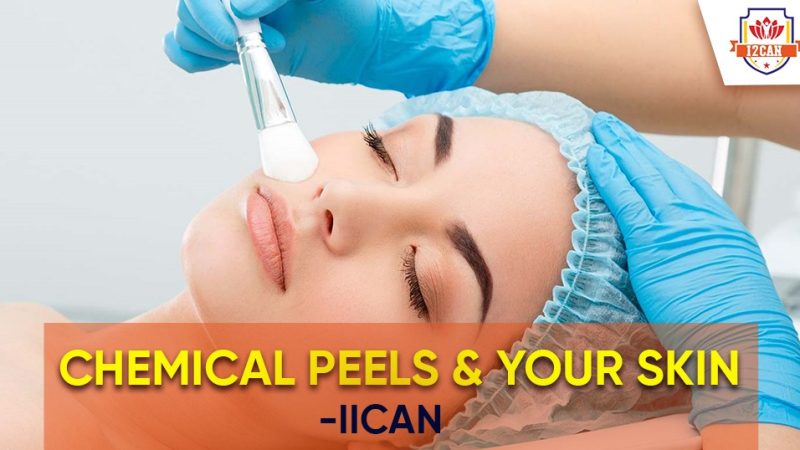 Chemical Peels and Your Skin - IICAN